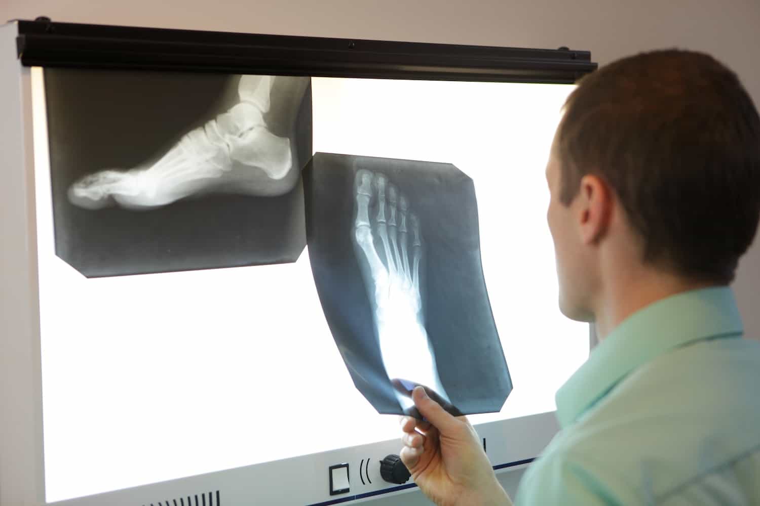 specialist watching x ray images of foot